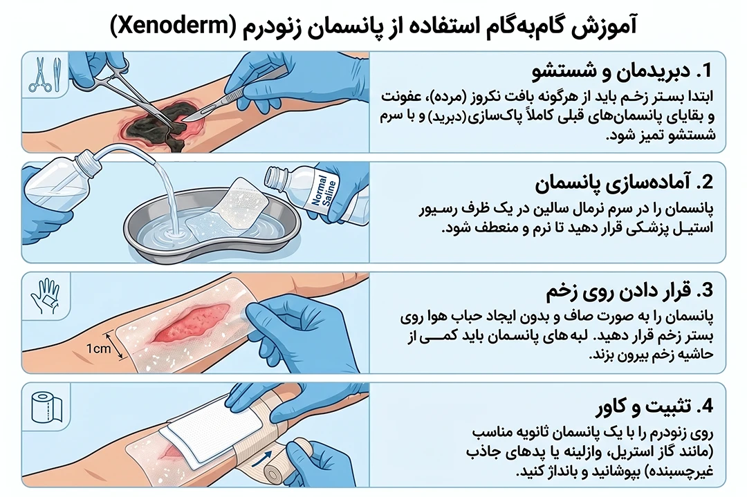 نحوه استفاده از پانسمان بیولوژیک پیشرفته زنودرم